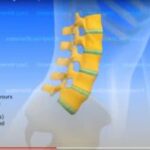 lumbar-spine-300x169